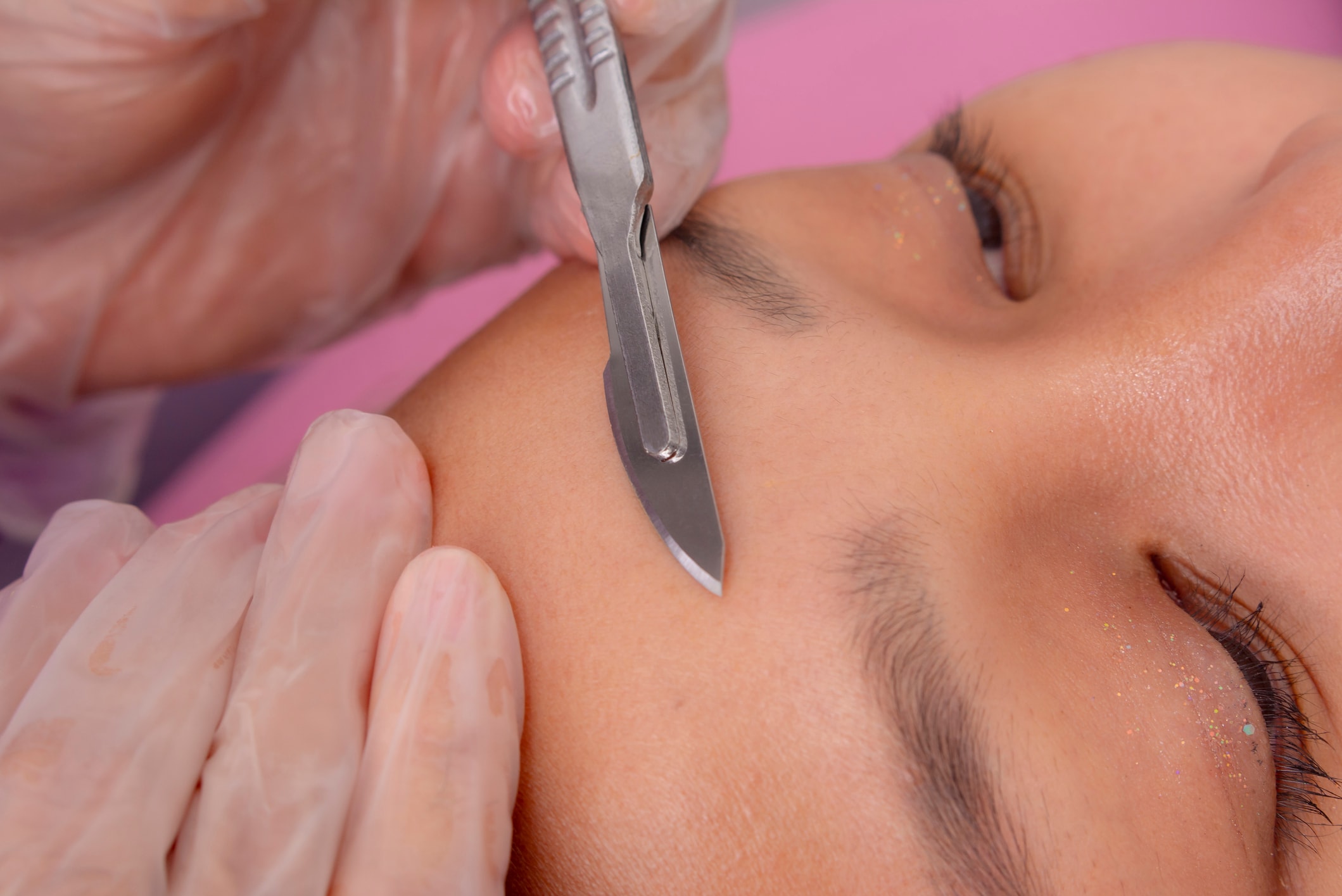 Dermaplaning facial treatment removing peach fuzz and dead skin