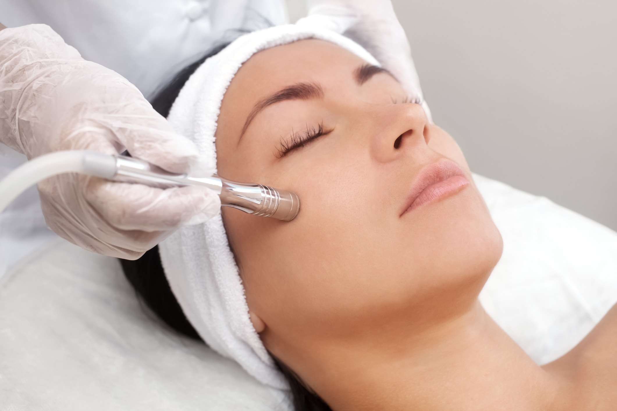 Microdermabrasion skin exfoliation treatment