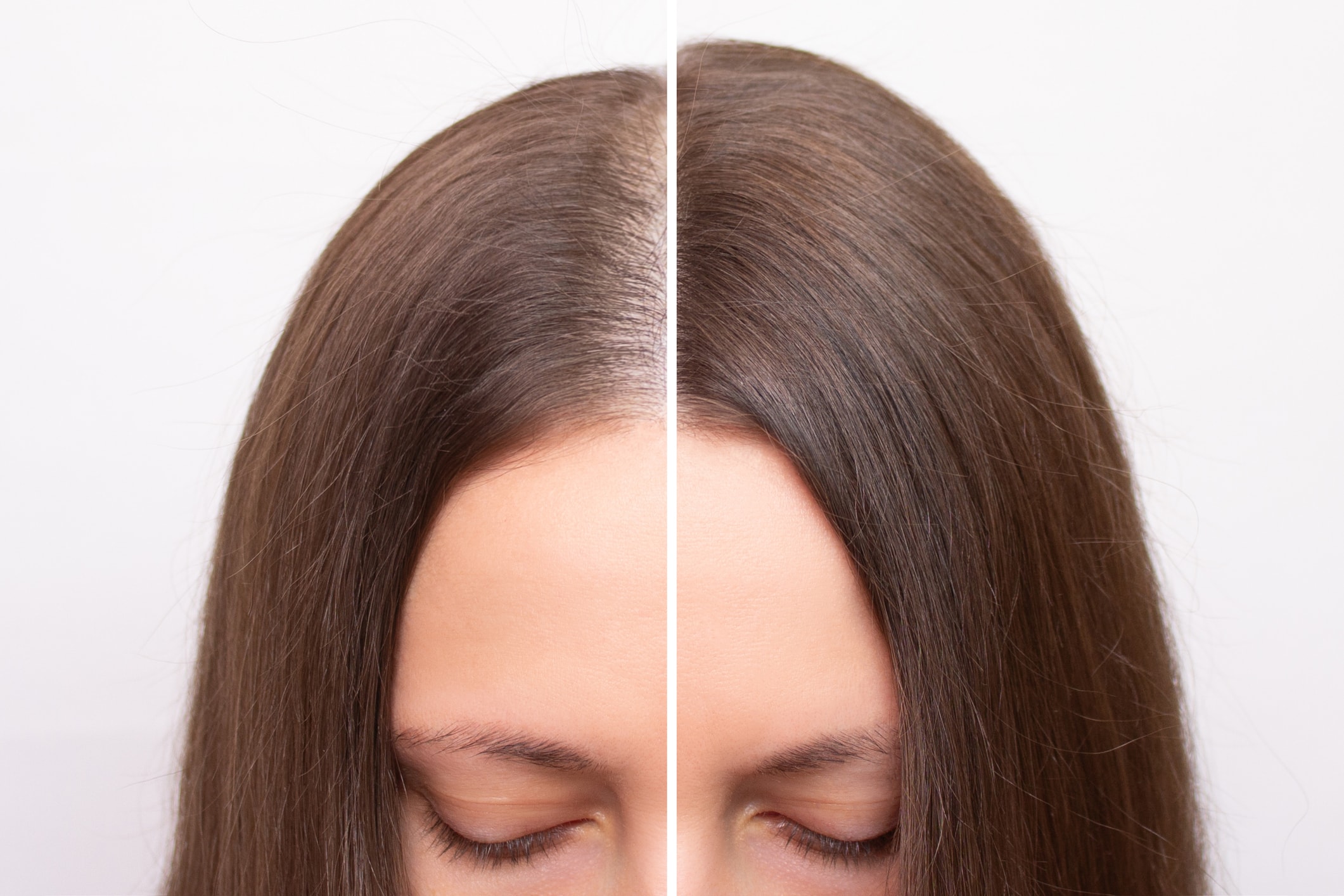 Female hair regrowth before and after — fuller, denser hair at the part line