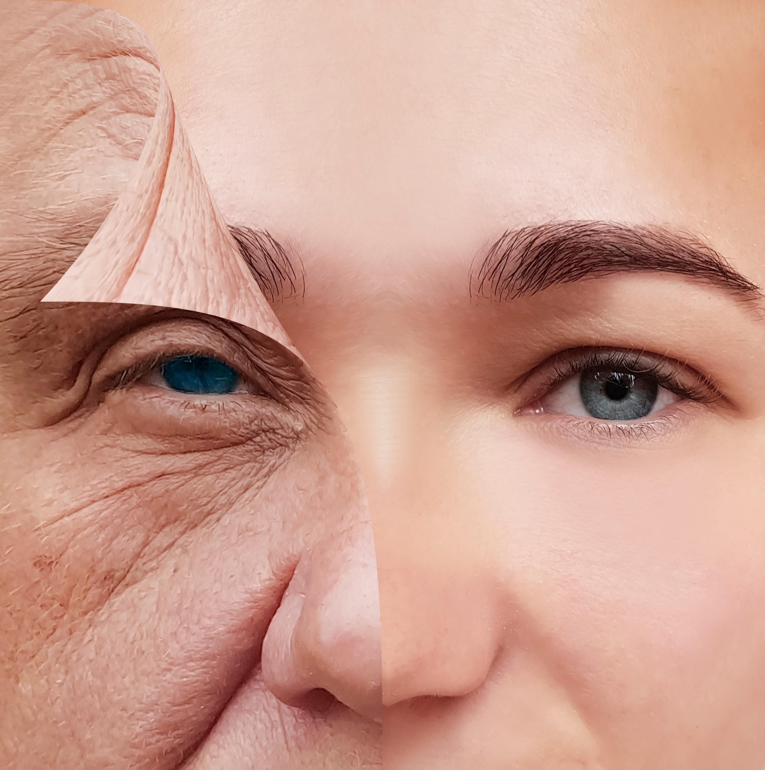 Before and after skin rejuvenation comparison showing dramatic improvement in skin texture and wrinkles
